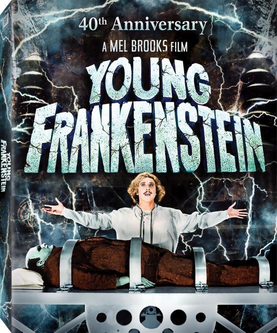 Marty Feldman in Young Frankenstein: Damn Your Eyes!